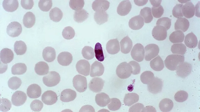 avian malaria