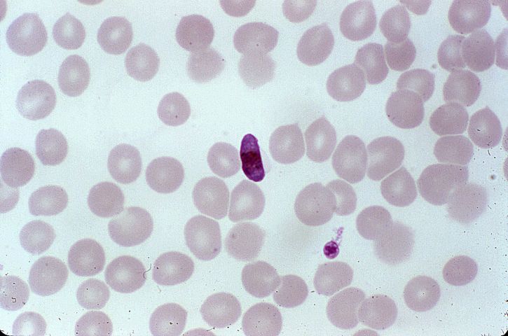 avian malaria