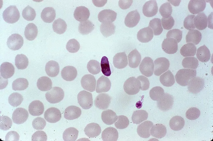 avian malaria
