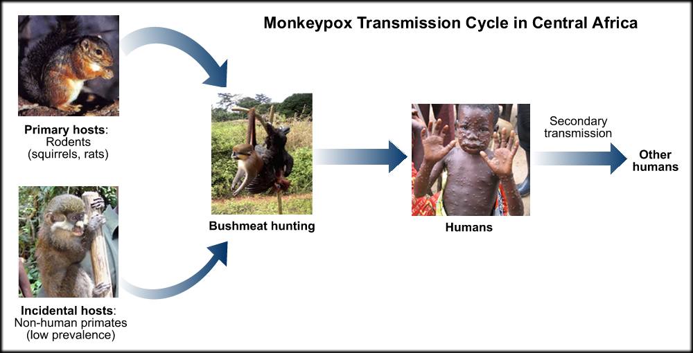 Who Is Most Vulnerable To The Monkeypox Virus?