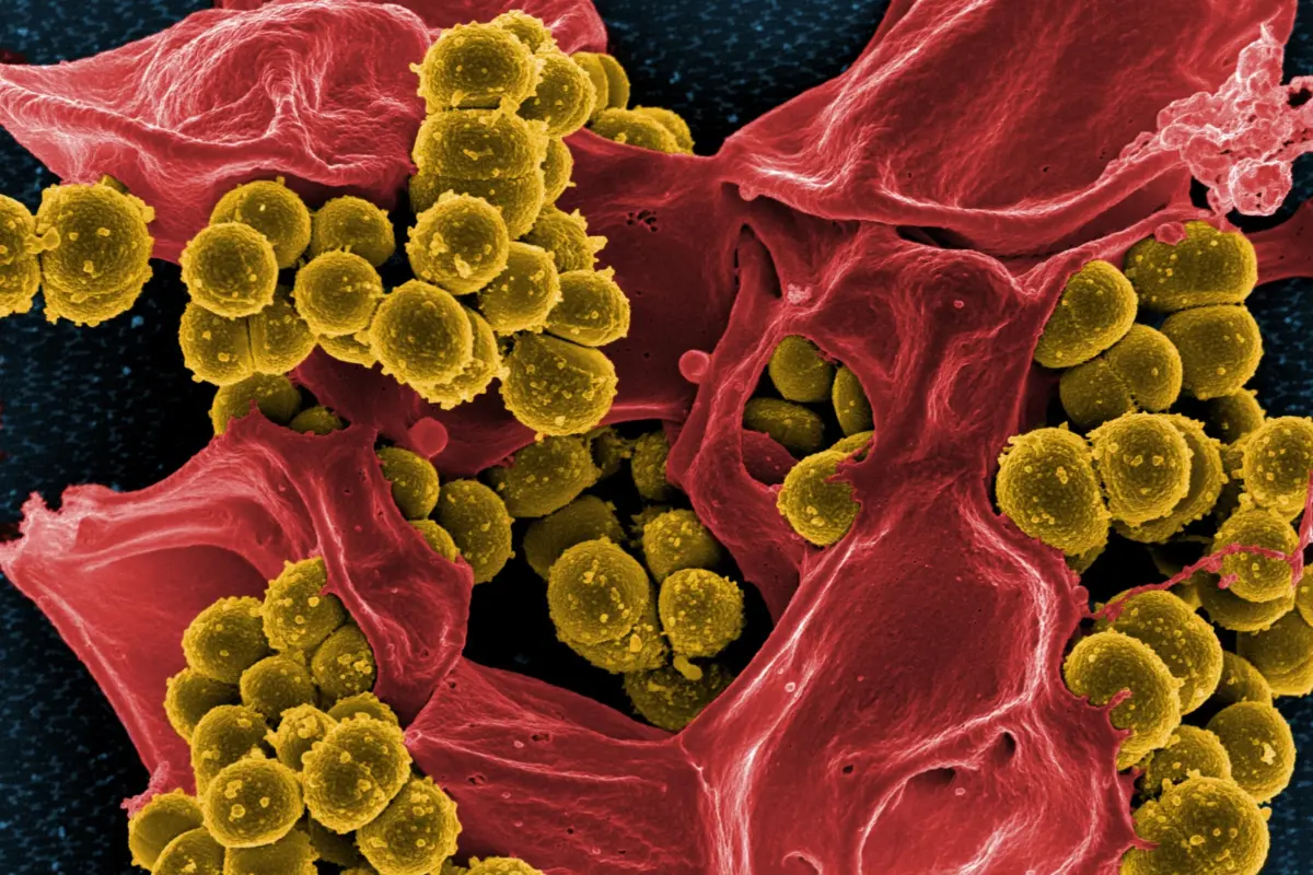antibiotic resistant genes lurk in city parks